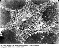 Une cellule en culture, vue au Microscope Eletronique a Balayage (MEB)